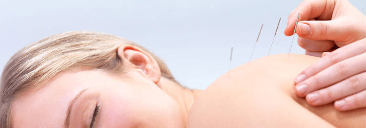 Chiropractic Calgary AB Acupuncture Chiropractic Calgary AB Acupuncture