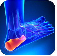 Chiropractic Calgary AB Orthotics