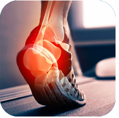 Chiropractic Calgary AB Orthotics